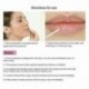 1X (a LANBENA Pink Lip Serum hidratáló, világító ajkak dugattyúja fokozza a T0C6-ot)