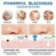 Blackhead Remover pórusos vákuum - arcbőr tisztító elektromos pattanásokkal járó Comedone F3L5