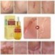 8X (Lanbena heg eltávolító szérum striák Pockmark javító Essence Face Cr H2X9