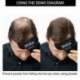 sevich Keratin Hair Building fodrász fésűk Hairline Optimizer 1 db / tétel C2R3