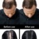 sevich Keratin Hair Building fodrász fésűk Hairline Optimizer 1 db / tétel C2R3