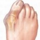 stílusú B-1Pár - 1 pár csont-hüvelykujj egyenesítő lábujjak szétválasztó Hallux Valgus Bunion Corrector lábápoló