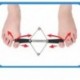 Szín: Korrektor öv - Hallux Valgus Corrector öv helyreállító edzés edzőheveder lábujjleválasztó hordágy hüvelykujj