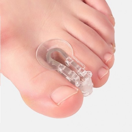 Szín: 2db - 2db Lábujjak elválasztó távtartók Hallux Valgus korrekciós szilikon párna hüvelykujj ortózis lábujjak