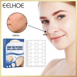 144db Akne láthatatlan pattanásos tapasz matricák Bőrcímke Távolítsa el a foltfoltot arcmaszk Bőrápolás