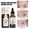 30 ml koffein C-vitamin szemészeti esszencia normál eltávolító szemtáska Eye Dark Circle öregedésgátló halványító